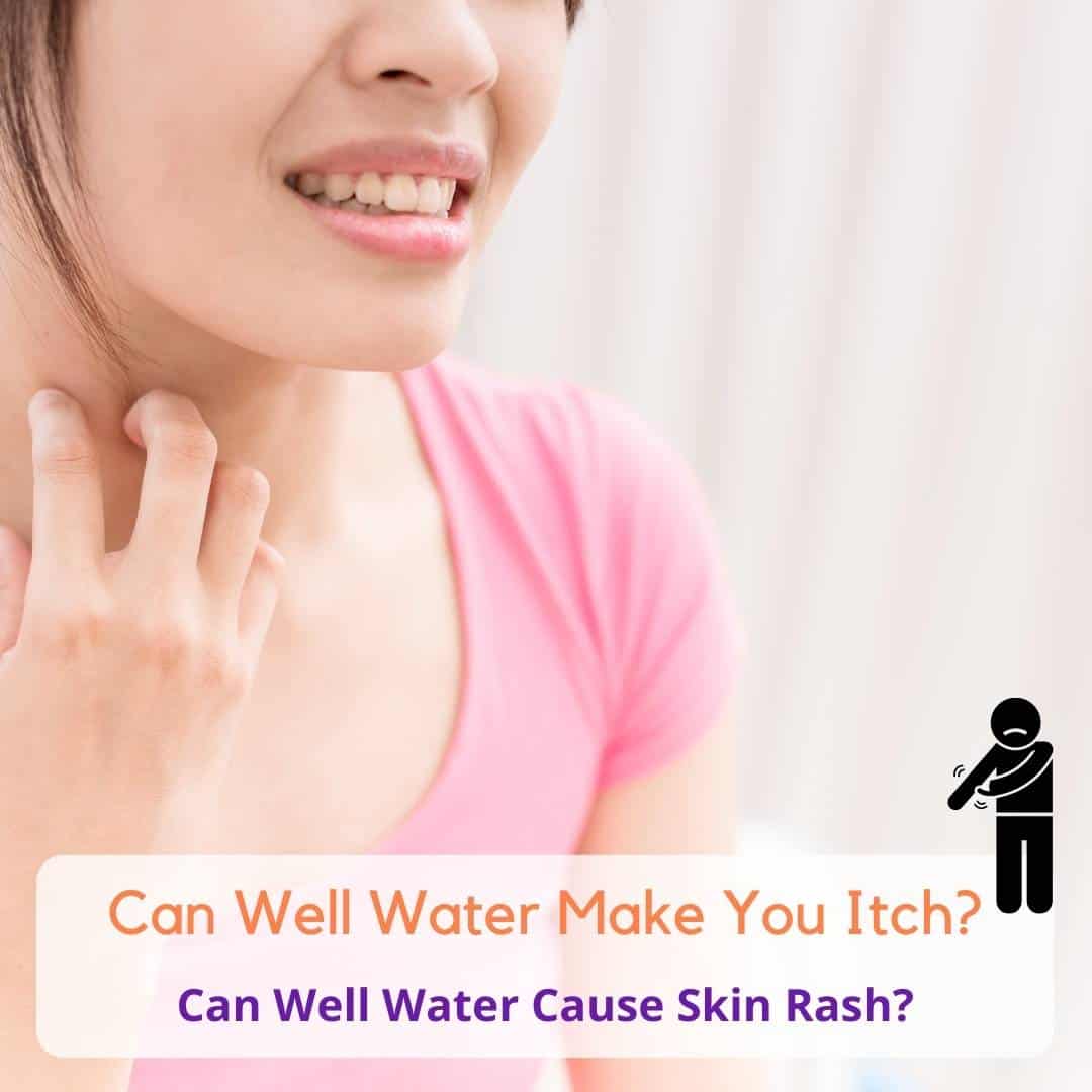 Can Well Water Make You Itch or Cause Skin Rashes?