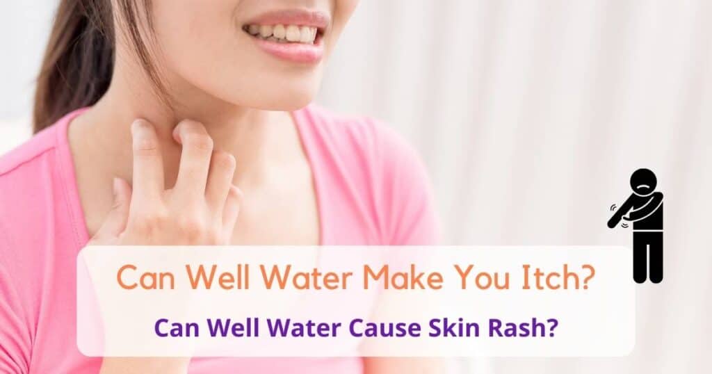 Can well water make you itch?